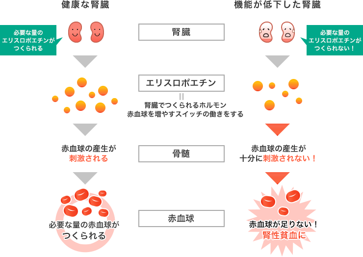 腎性貧血とは 知ろう ふせごう 慢性腎臓病 Ckd