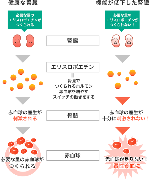 腎性貧血とは 知ろう ふせごう 慢性腎臓病 Ckd