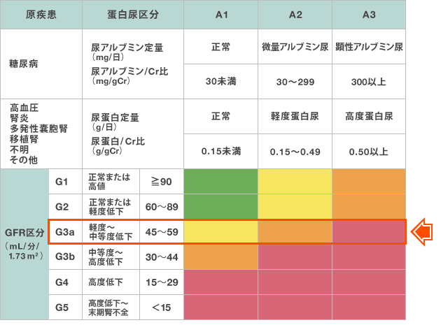 GFR敪
