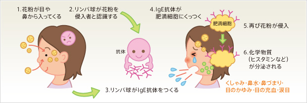 図：花粉症のメカニズム