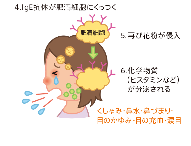 花粉症のメカニズム 花粉症ナビ