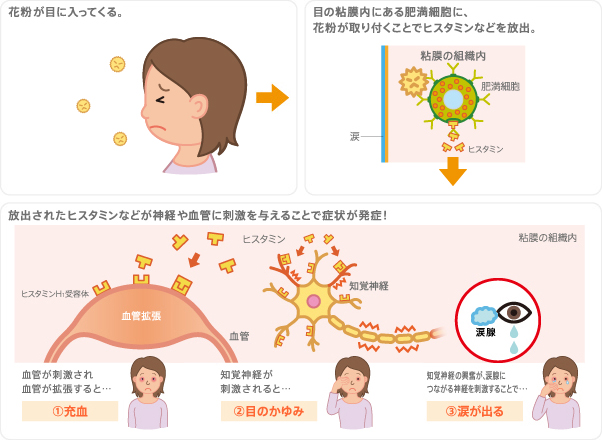 花粉 症 目 が 痛い