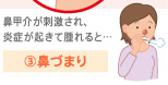 3.鼻づまり 鼻甲介が刺激され、炎症が起きて腫れると…