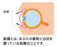 結膜とは、まぶたの裏側と白目を覆っている粘膜のことです。