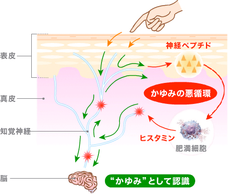 かゆみのしくみ かゆみナビ