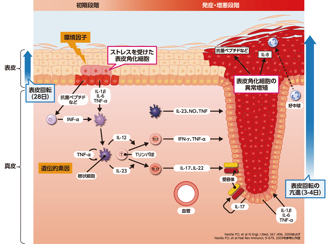 乾癬の発症に関与する免疫の異常(イメージ図)