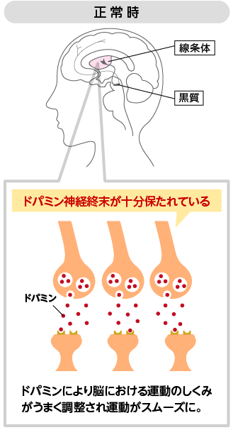 正常時